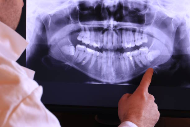 Best Emergency Dental Filling Replacement  in Rutgers University Busch Campus, NJ