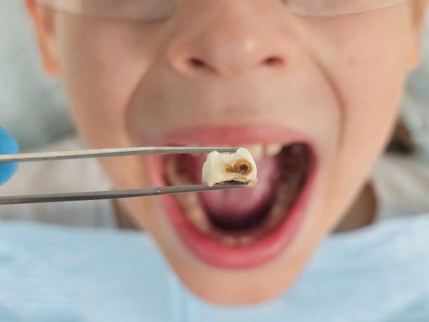 Best Tooth Pain Emergency Relief  in Rutgers University Busch Campus, NJ