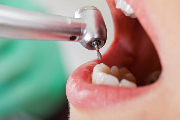Best Dentist for Tooth Abscess  in Rutgers University Busch Campus, NJ